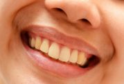 افزایش تمایل به داشتن دندان های زیبا