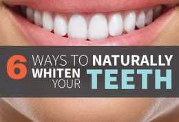 راهکارهای خانگی برای سفیدتر شدن دندان