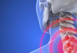 نحوه پیشگیری و درمان آرتروز گردن