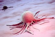 ایجاد سلولهای سرطانی در بدن