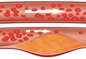 شناخت خوراکی‌های کاهنده کلسترول خون