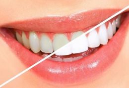 روشی خانگی برای سفید کردن دندان