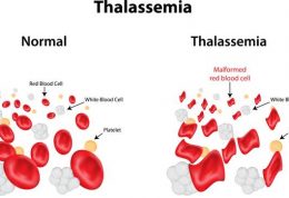 اطلاعات پزشکی پیرامون تالاسمی