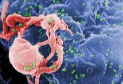 اطلاعات کامل درباره ایدز و سرطان های وابسته به آن