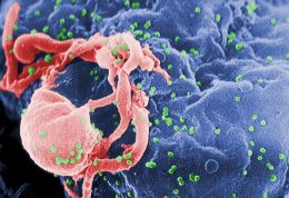 اطلاعات کامل درباره ایدز و سرطان های وابسته به آن