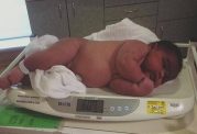 به دنیا آمدن تپل ترین نوزاد جهان