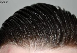 راهکارهایی برای جلوگیری از چرب شدن با موها