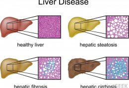 هشدار بدن برای اختلالات کبدی