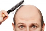 شامپوی طبیعی برای درمان ریزش مو