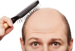 ژن هایی که باعت ریزش مو در مردان می شوند