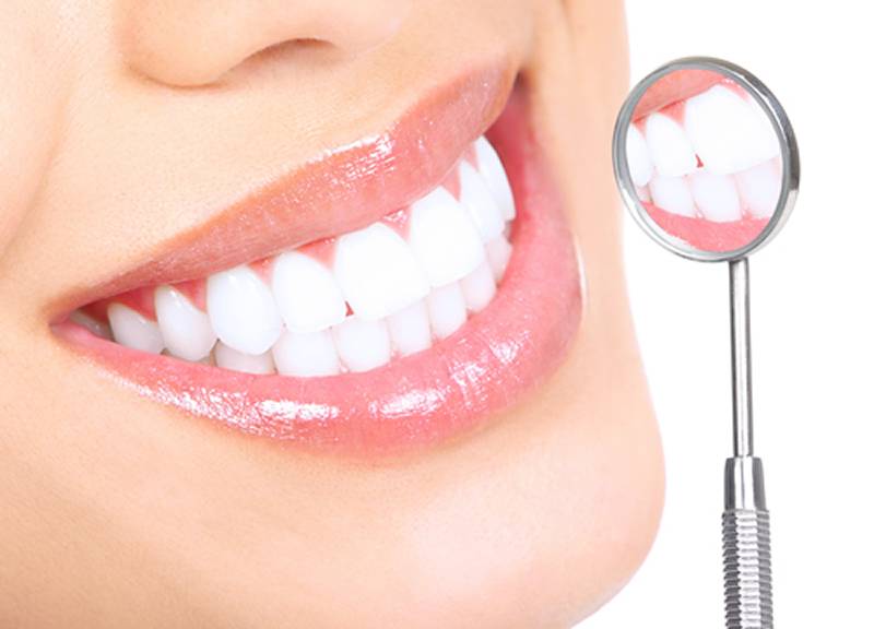 پاسخ به تمامی سوالات شما در مورد لمینیت دندان