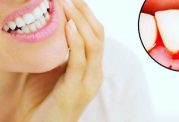 آسیب به دندان با عوامل تاثیرگذار