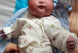 تولد نوزاد 7 کیلویی در چین