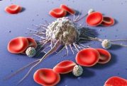 روش کوچک شدن تومورهای سرطانی در کبد