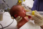 نوزادان نارس در معرض مبتلا شدن به بیماریهای ریوی و قلبی قرار دارند