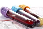طریقه ی خواندن آزمایش خون بارداری