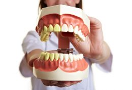 مواد غذایی تاثیرگذار بر دندان ها