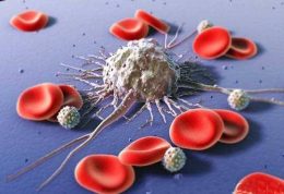 شایع ترین علائم سرطان خون را بشناسیم