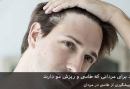 روش های جدید برای مردانی که طاسی و ریزش مو دارند