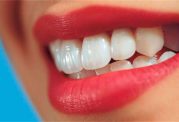 نکاتی که قبل از سفید کردن دندان باید بدانید