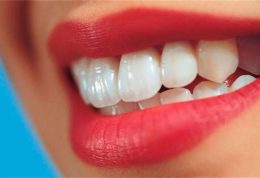نکاتی که قبل از سفید کردن دندان باید بدانید