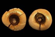 کشف نخستین دندانهای پرشده در ایتالیا