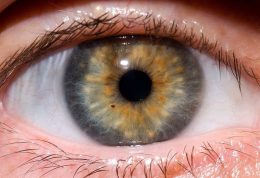 بررسی انواع عارضه ها در بدن از طریق چشم
