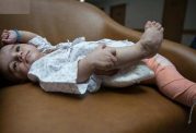 نوزاد عراقی که با هشت دست و پا به دنیا آمد