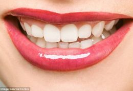 ارتباط دندان سالم و طول عمر در خانم ها