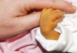 ارتباط گروه خونی مادر و نوزاد در ابتلای نوزادان به زردی