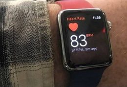 مشاهده ضربان نامنظم قلب را با ساعت هوشمند اپل