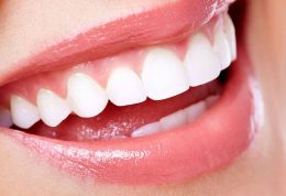 درمان های زیبایی دندان توسط دکتر مجید فر