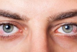 روزه گرفتن مبتلایان به بیماری چشمی