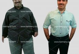 آشنایی با جدیدترین رکورددار رژیم دکتر کرمانی