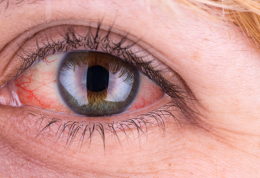 ارتباط لکه های درون چشم با دیابت