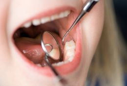 نکاتی که باید در خصوص پوسیدگی دندان بدانید