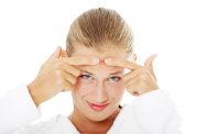 درمان جوش صورت و بدن با کمک طب سنتی