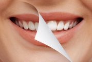 راهکارهای طبیعی برای سفید کردن دندان ها