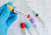 چگونه ابتلا به بیماری هپاتیت c را تشخیص دهیم