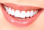 معرفی 6 سفید کننده طبیعی دندان برای داشتن لبخندی زیبا