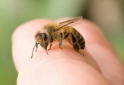 نیش زنبور و روش های درمان آن