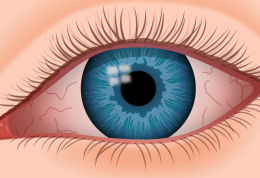 درمان خشکی چشم با معده خوک