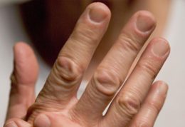 اصلی ترین اختلالات مفصلی انگشت و روش های درمان آن