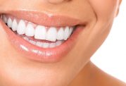 انجام ارتودنسی عاملی موثر بر سلامت دندانها