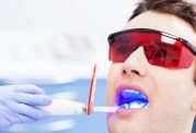 روش نوین برای درمان پوسیدگی دندان