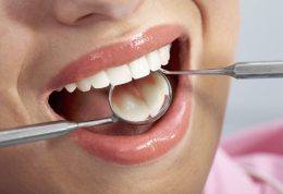 آیا قصور در دندان‌پزشکی امری عادی و طبیعی است؟