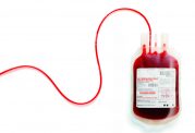توصیه وزیر بهداشت در خصوص هفته مدیریت خون بیمار