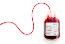 چه تغییراتی در سیستم عروقی بدن با اهدای خون ایجاد می شود؟