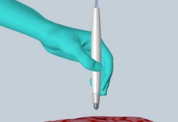 با این دستگاه قلمی شکل، بافت سرطانی را تشخیص دهید