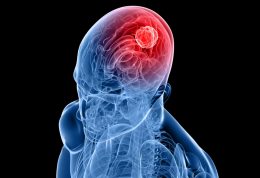 تومور مغزی چه نشانه هایی دارد؟